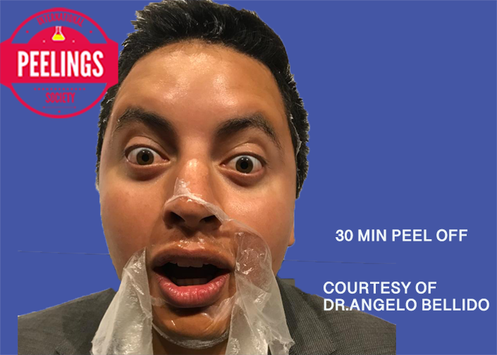 Peel Off : Peeling de 30 minutos