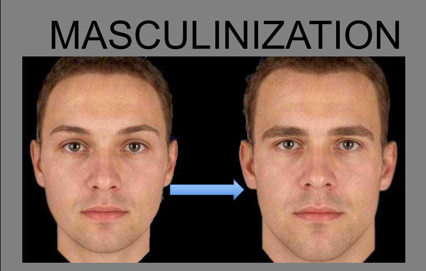 face masculinization
