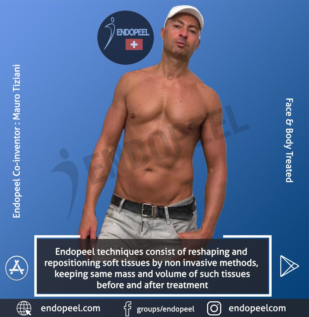endopeel techniques